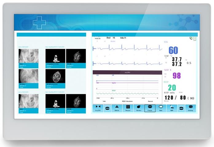 ADLINK MLC 5-21HE Medical AIO i7-5700EQ/8GB/128GB SSD *TouchScreen* *No Stand* ADLINK MLC 5-21HE Medical AIO i7-5700EQ/8GB/128GB SSD *TouchScreen* *No Stand*